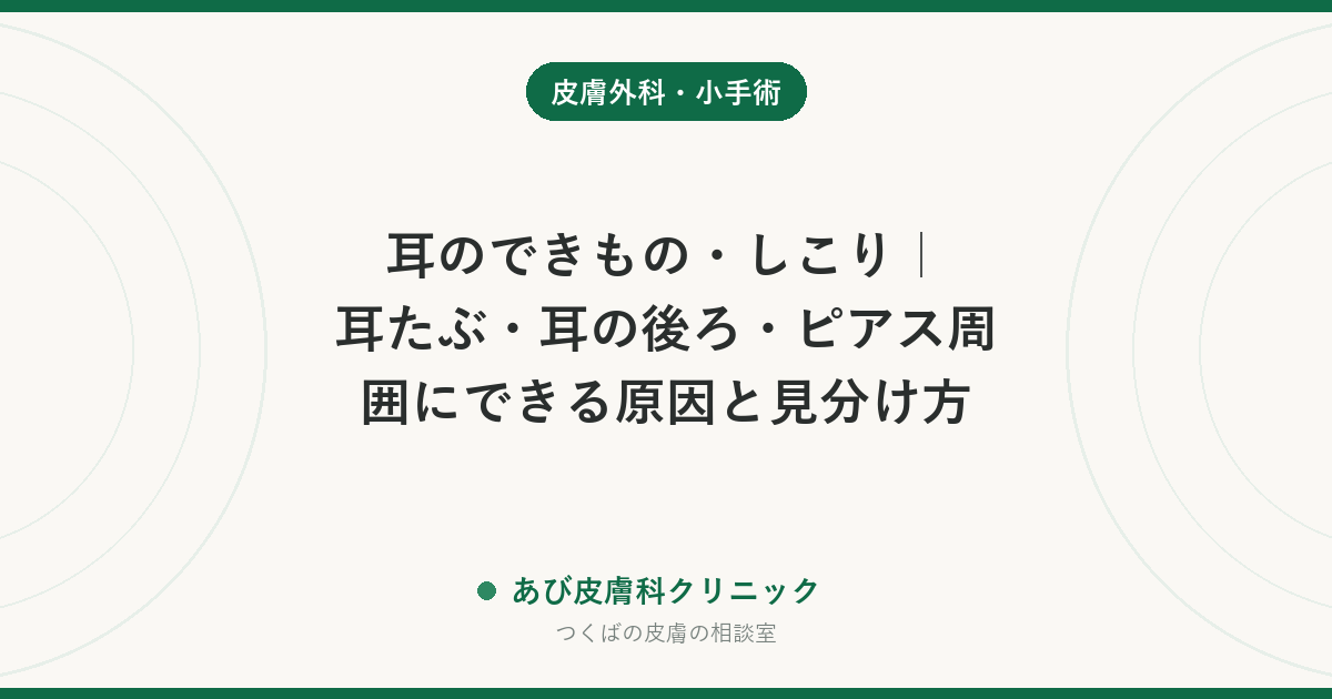 耳のできもの・しこり｜耳たぶ・耳の後ろ・ピアス周囲にできる原因と見分け方