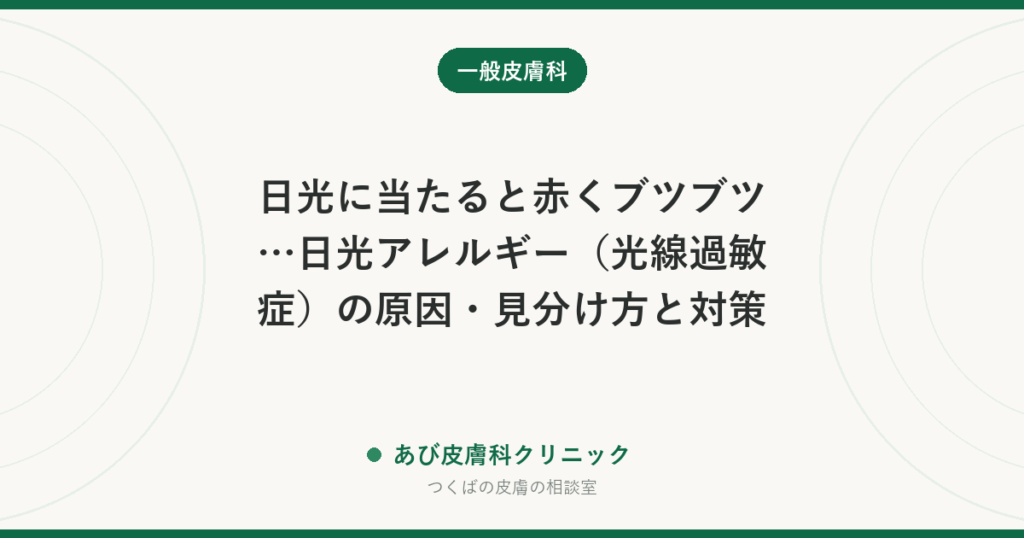 日光に当たると赤くブツブツ…日光アレルギー（光線過敏症）の原因・見分け方と対策