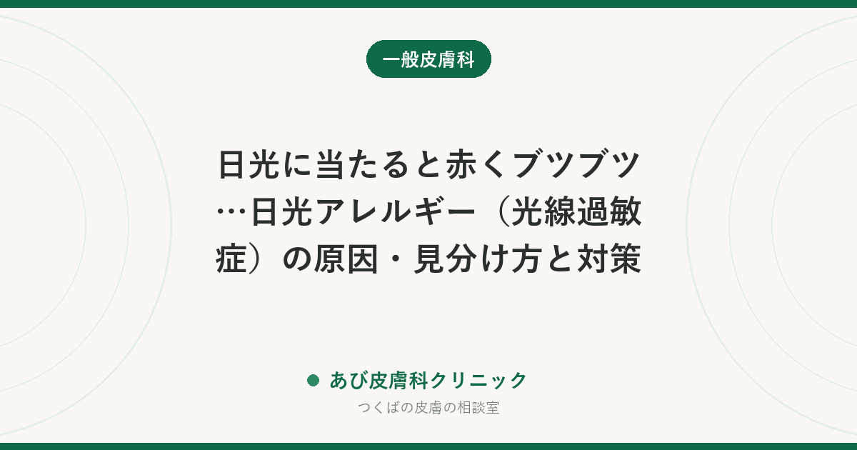 日光に当たると赤くブツブツ…日光アレルギー（光線過敏症）の原因・見分け方と対策