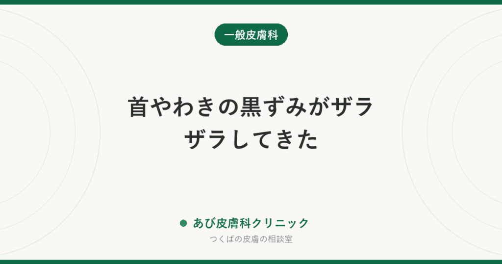 首やわきの黒ずみがザラザラしてきた｜黒色表皮腫とは？こすりによる色素沈着との違いと対処