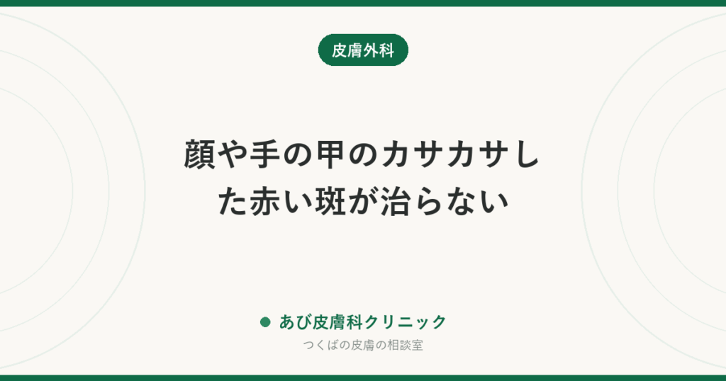 顔や手の甲のカサカサした赤い斑が治らない｜日光角化症とシミ・湿疹の見分け方