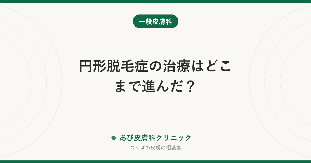 円形脱毛症の治療はどこまで進んだ？｜重症例の新しい飲み薬と、治療を選ぶ順番