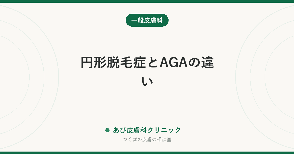 円形脱毛症とAGAの違い｜抜け方・進み方での見分け方と、治療がまったく別物である理由