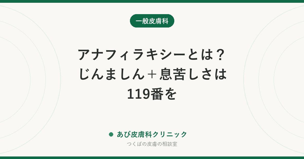 アナフィラキシーとは？じんましん＋息苦しさは119番を｜皮膚に出るサインと、エピペンの使いどき・再発を防ぐ準備