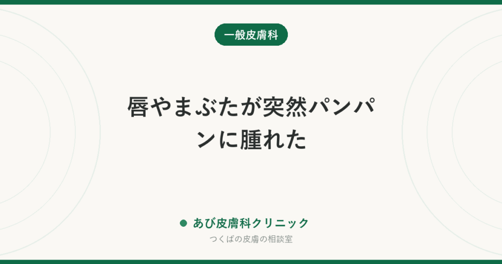 唇やまぶたが突然パンパンに腫れた｜血管性浮腫（クインケ浮腫）の見分け方と急ぐべきサイン