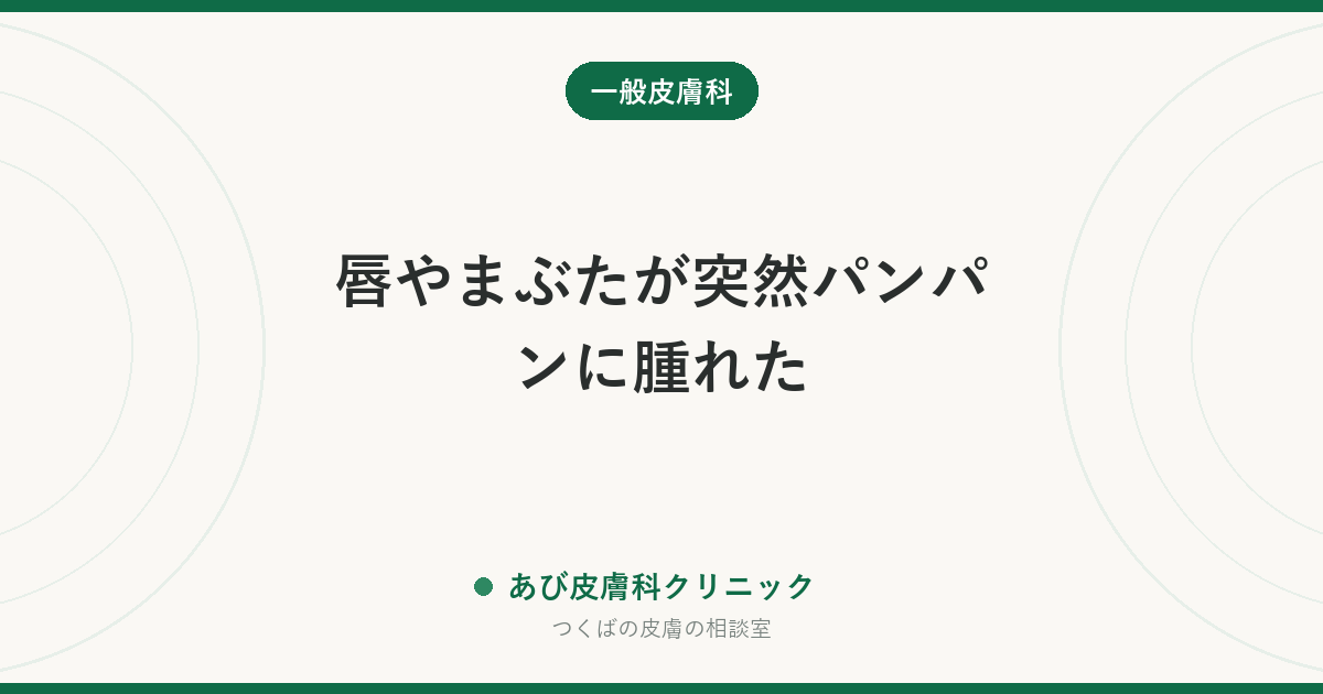 唇やまぶたが突然パンパンに腫れた｜血管性浮腫（クインケ浮腫）の見分け方と急ぐべきサイン