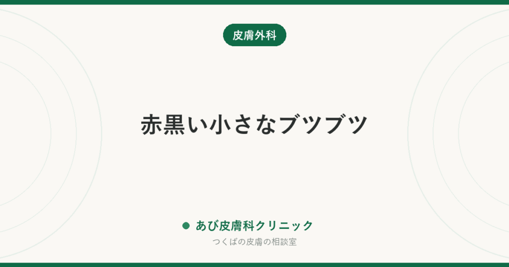 赤黒い小さなブツブツ｜被角血管腫（ひかくけっかんしゅ）とは？陰部・足にできる理由、ほくろとの違いと治療