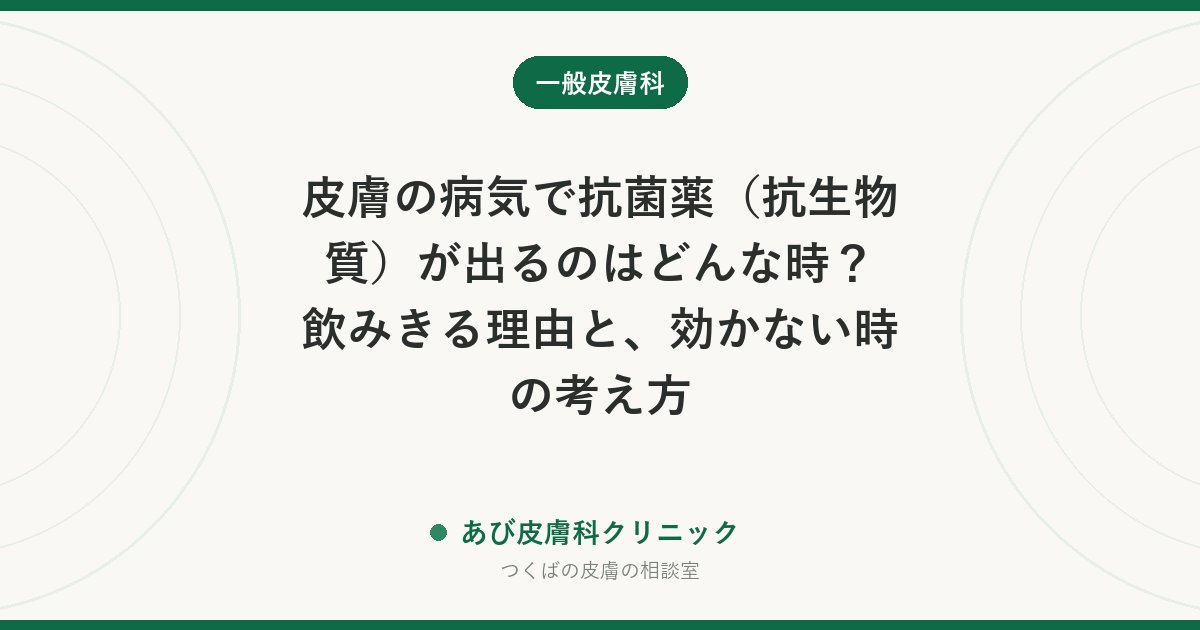 皮膚の病気で抗菌薬（抗生物質）が出るのはどんな時？飲みきる理由と、効かない時の考え方