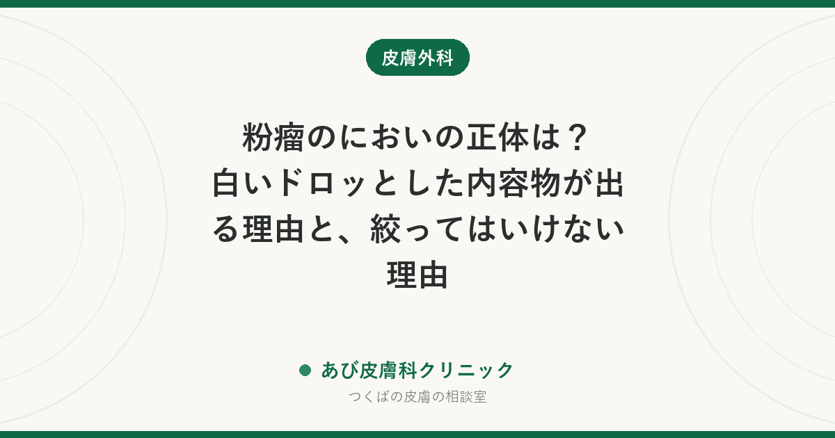 粉瘤のにおいの正体は？白いドロッとした内容物が出る理由と、絞ってはいけない理由