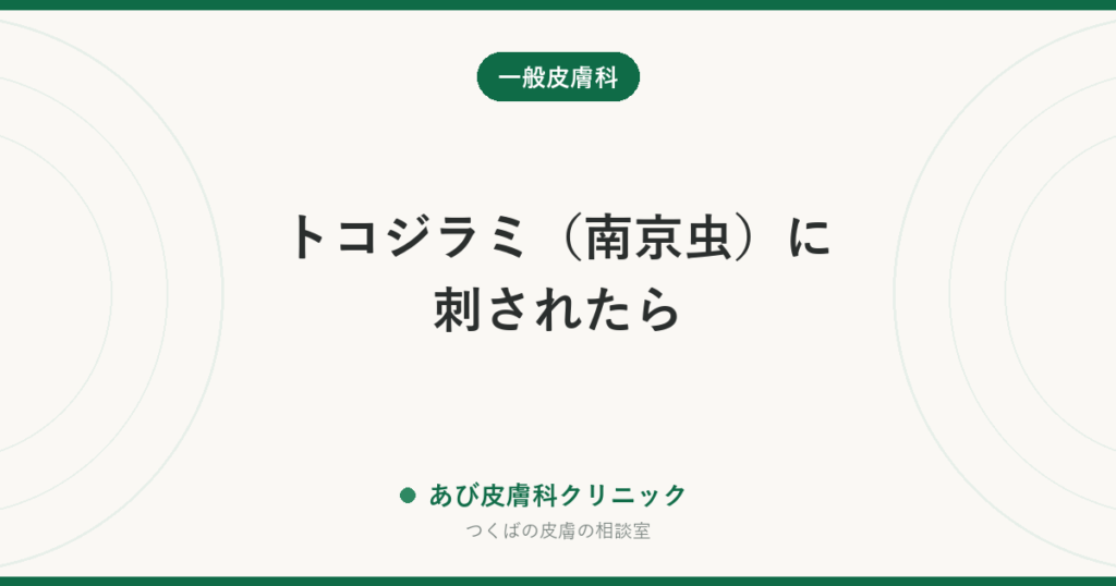 トコジラミ（南京虫）に刺されたら｜刺され跡の特徴・ほかの虫との見分けと持ち帰らない対策