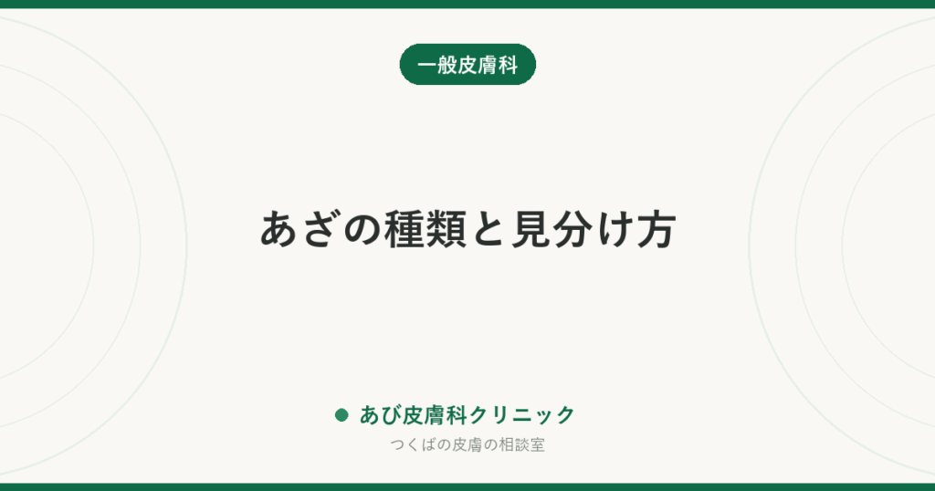 あざの種類と見分け方｜茶あざ・青あざ・赤あざの違いと、相談したほうがよい目安