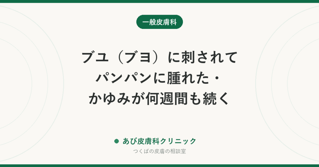ブユ（ブヨ）に刺されてパンパンに腫れた・かゆみが何週間も続く｜蚊との違い、早めのステロイドが大切な理由