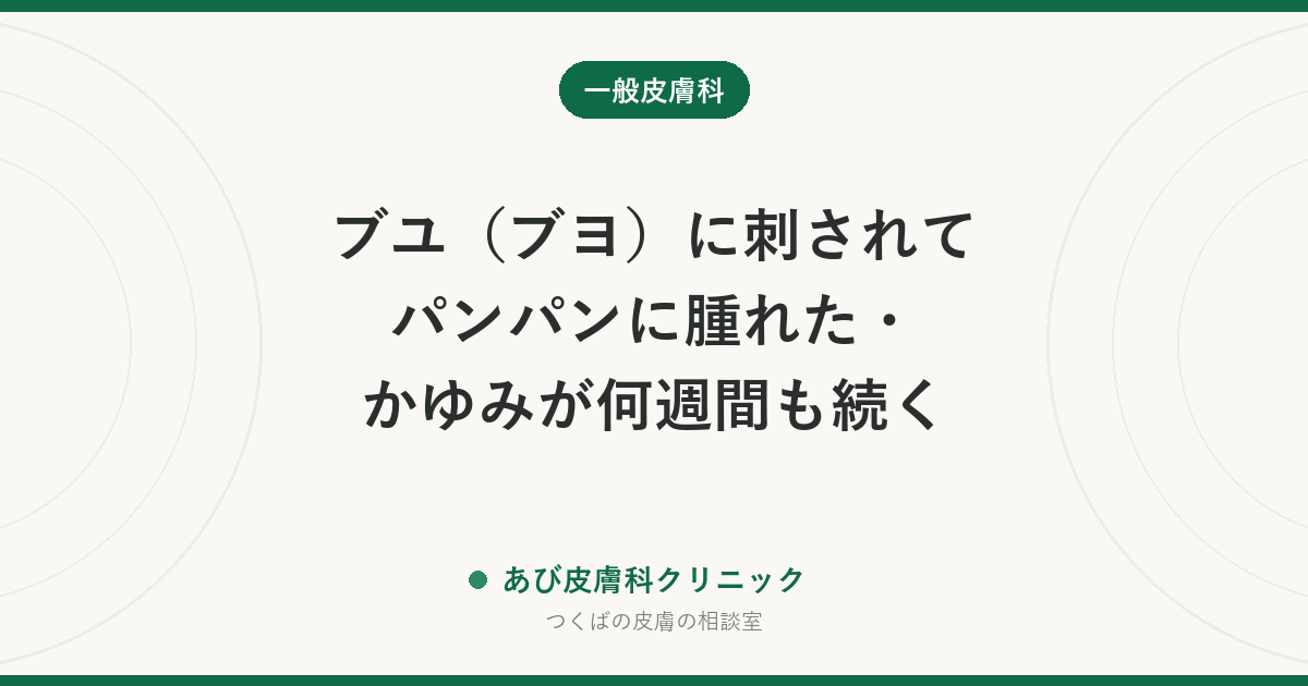 ブユ（ブヨ）に刺されてパンパンに腫れた・かゆみが何週間も続く｜蚊との違い、早めのステロイドが大切な理由