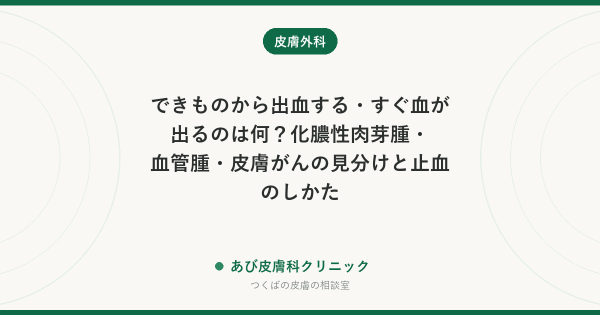 できものから出血する・すぐ血が出るのは何？化膿性肉芽腫・血管腫・皮膚がんの見分けと止血のしかた