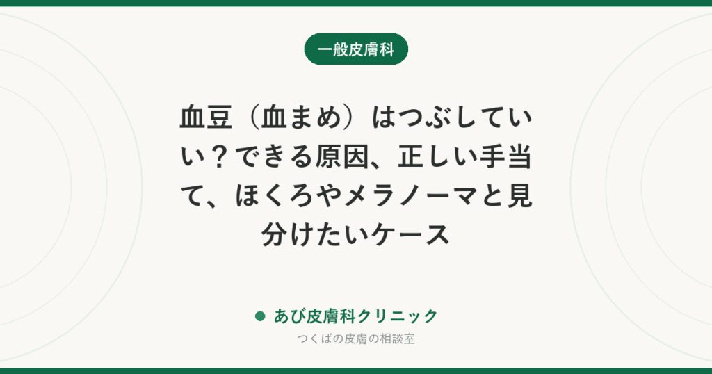 血豆（血まめ）はつぶしていい？できる原因、正しい手当て、ほくろやメラノーマと見分けたいケース
