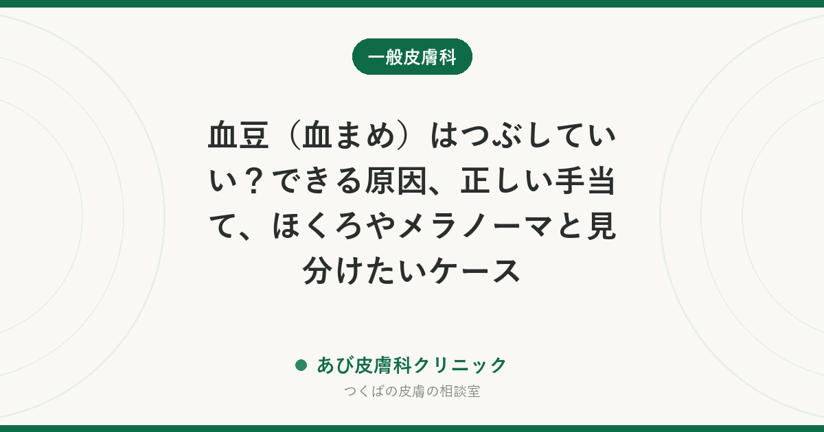 血豆（血まめ）はつぶしていい？できる原因、正しい手当て、ほくろやメラノーマと見分けたいケース