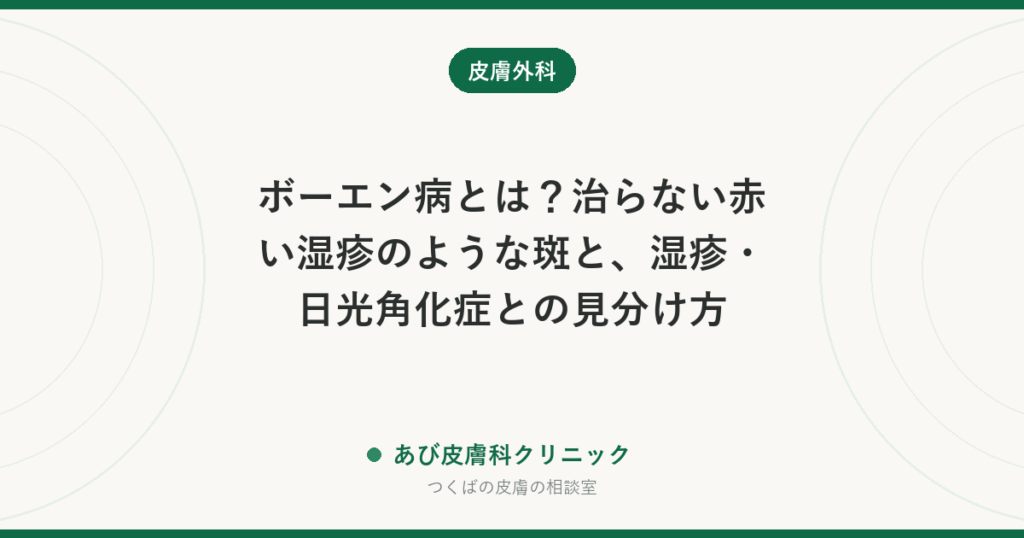 ボーエン病とは？治らない赤い湿疹のような斑と、湿疹・日光角化症との見分け方