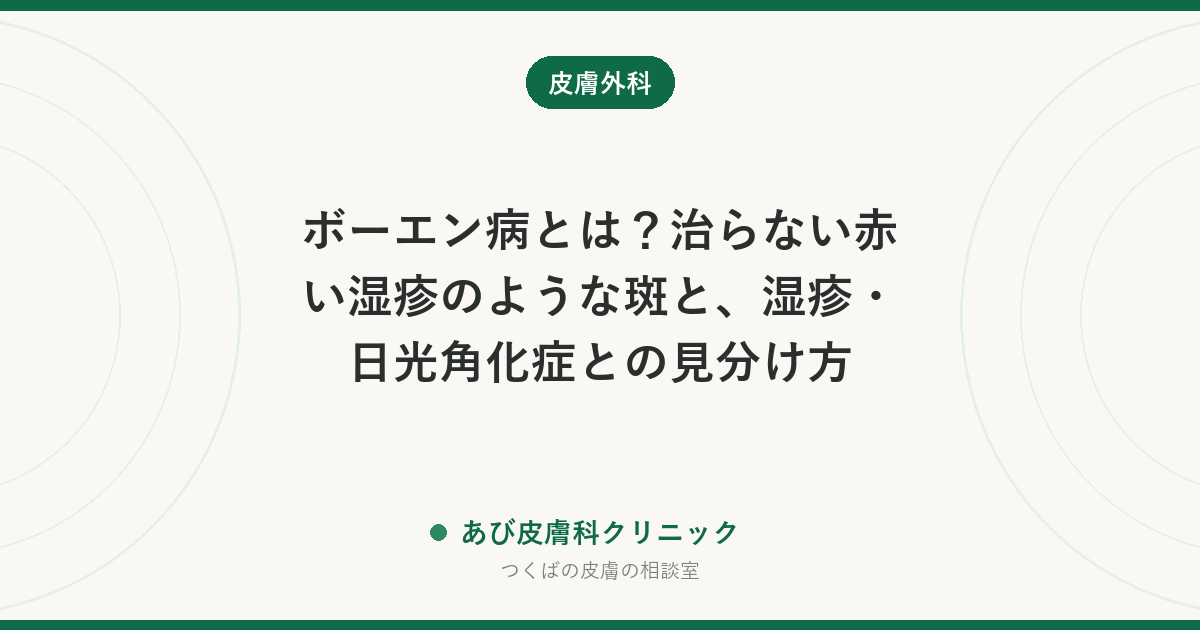 ボーエン病とは？治らない赤い湿疹のような斑と、湿疹・日光角化症との見分け方