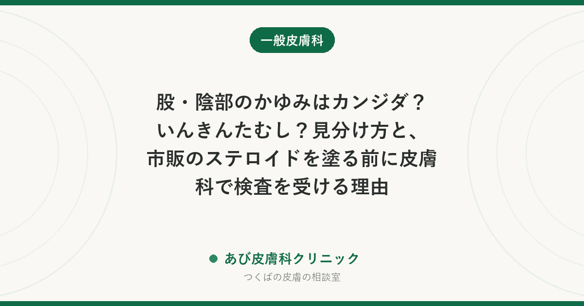 股・陰部のかゆみはカンジダ？いんきんたむし？見分け方と、市販のステロイドを塗る前に皮膚科で検査を受ける理由