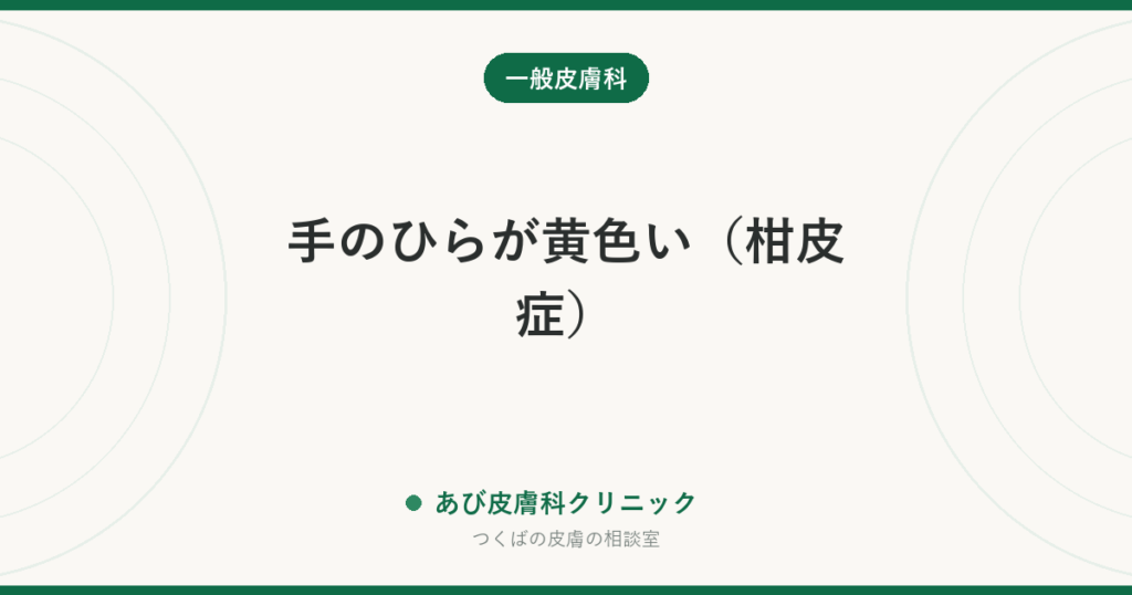 手のひらが黄色い（柑皮症）｜みかんの食べすぎが原因のことが多い。黄疸との見分けは白目を見る