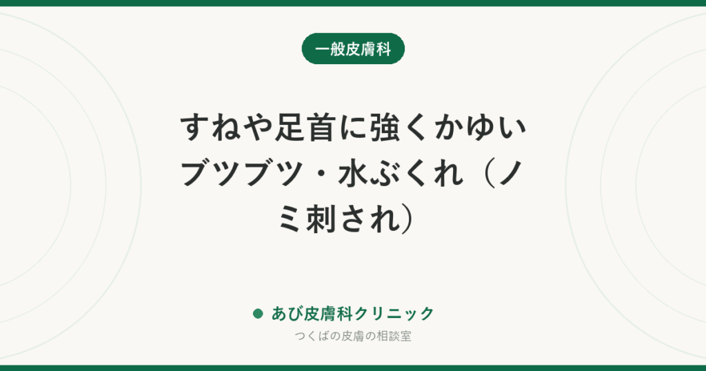 すねや足首に強くかゆいブツブツ・水ぶくれ（ノミ刺され）｜ネコノミの見分け方と、ペット・家の対策までセットで行う理由
