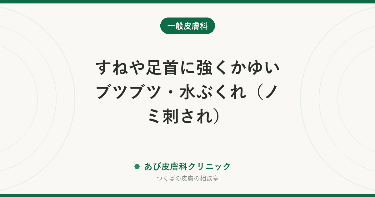 すねや足首に強くかゆいブツブツ・水ぶくれ（ノミ刺され）｜ネコノミの見分け方と、ペット・家の対策までセットで行う理由