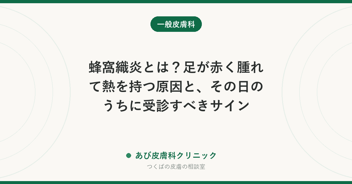 蜂窩織炎とは？足が赤く腫れて熱を持つ原因と、その日のうちに受診すべきサイン