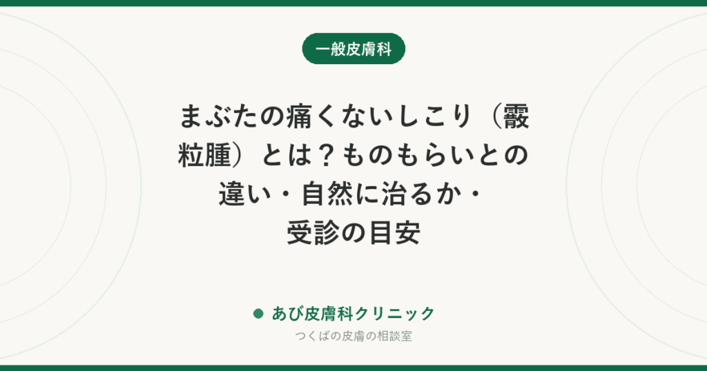まぶたの痛くないしこり（霰粒腫）とは？ものもらいとの違い・自然に治るか・受診の目安