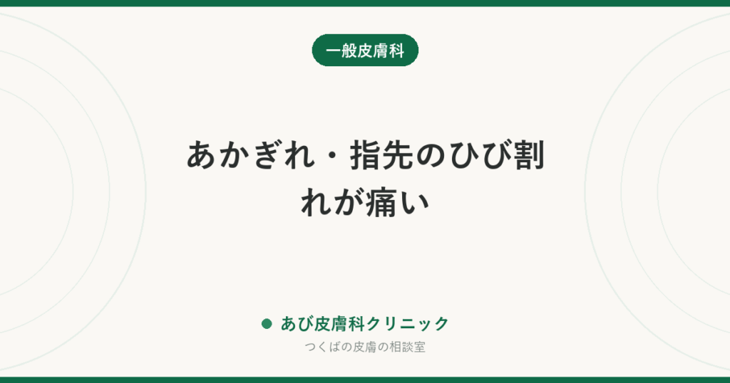 あかぎれ・指先のひび割れが痛い｜治らない理由と、冬に繰り返さないための手当て