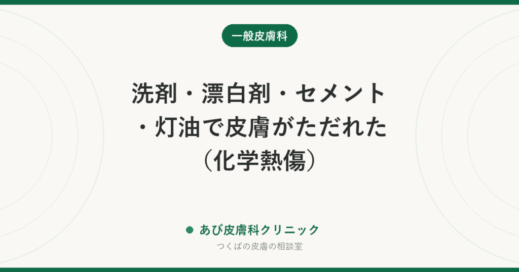 洗剤・漂白剤・セメント・灯油で皮膚がただれた（化学熱傷）｜すぐに流水で長く洗う応急処置と受診の目安