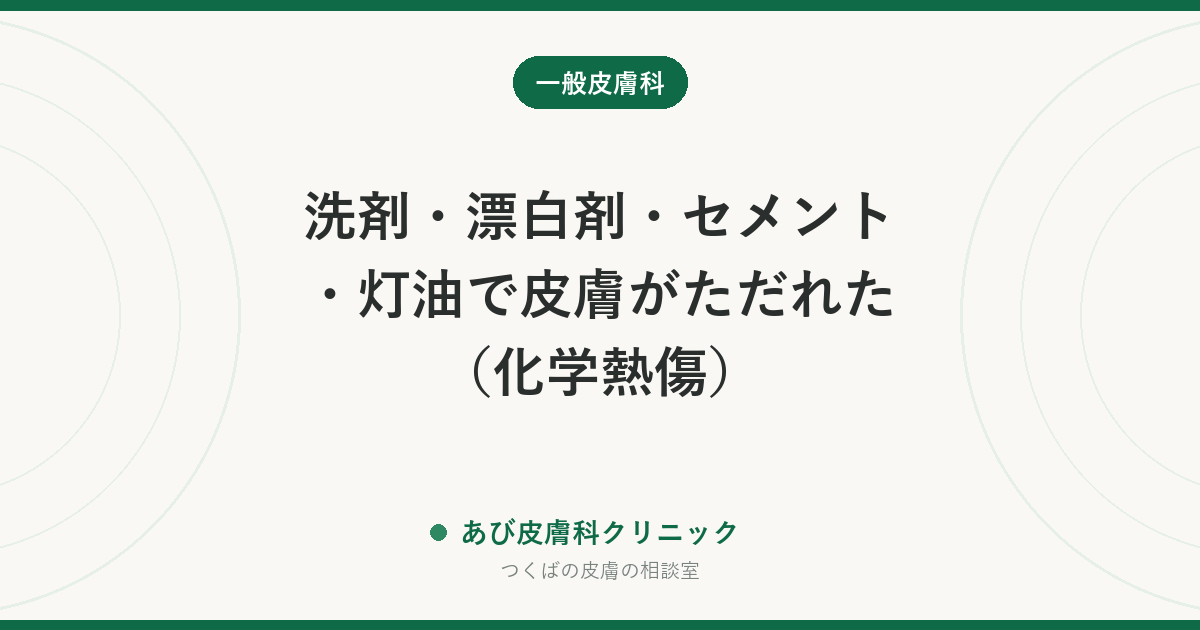 洗剤・漂白剤・セメント・灯油で皮膚がただれた（化学熱傷）｜すぐに流水で長く洗う応急処置と受診の目安