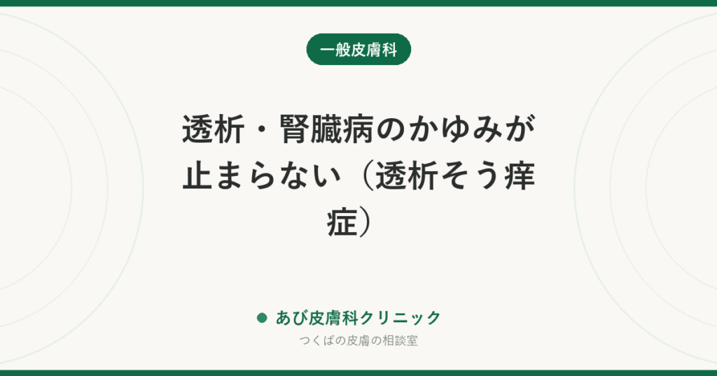 透析・腎臓病のかゆみが止まらない（透析そう痒症）｜原因と治療、市販のかゆみ止めを自己判断で飲まない理由