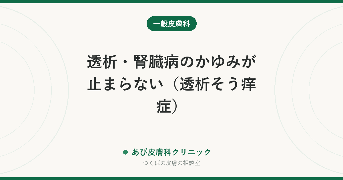 透析・腎臓病のかゆみが止まらない（透析そう痒症）｜原因と治療、市販のかゆみ止めを自己判断で飲まない理由