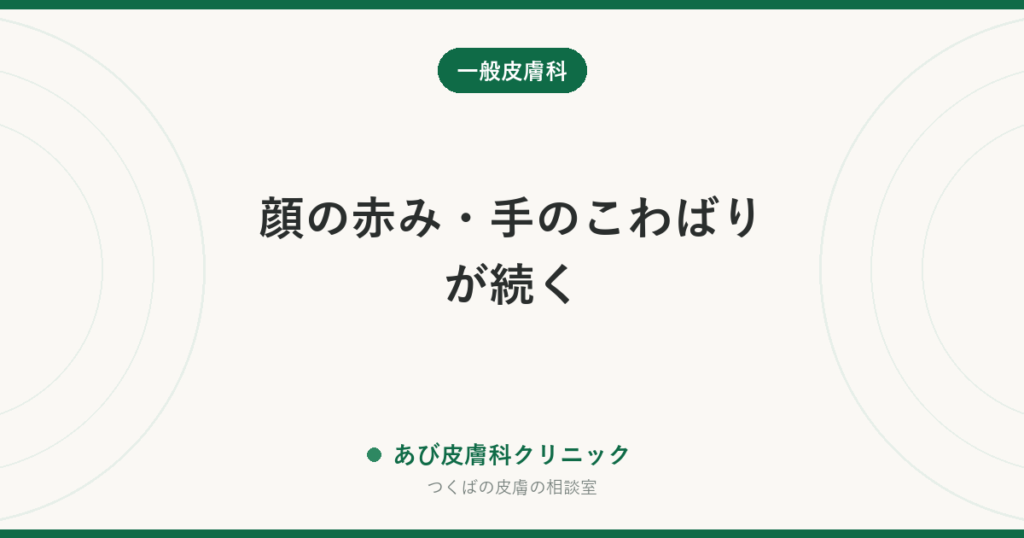 顔の赤み・手のこわばりが続く｜膠原病が皮膚に出すサインと、皮膚科で見ているポイント