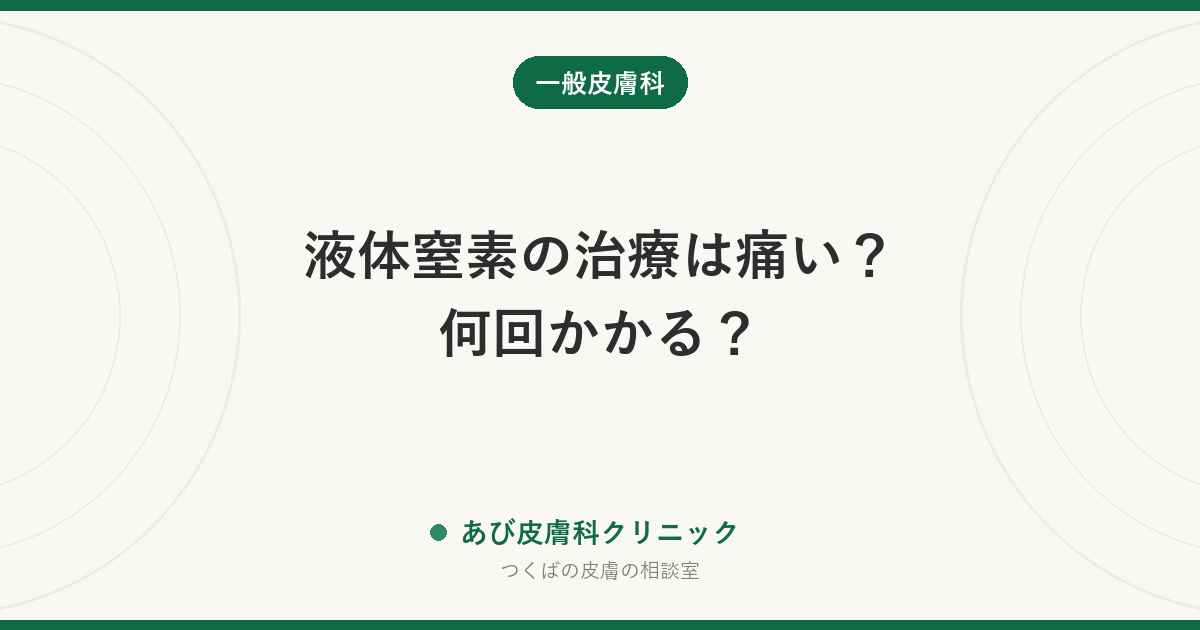 液体窒素の治療は痛い？何回かかる？｜イボの凍結療法で知っておきたいこと