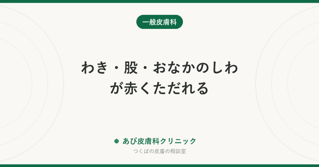 わき・股・おなかのしわが赤くただれる｜皮膚カンジダ症の特徴・あせもや水虫との見分け