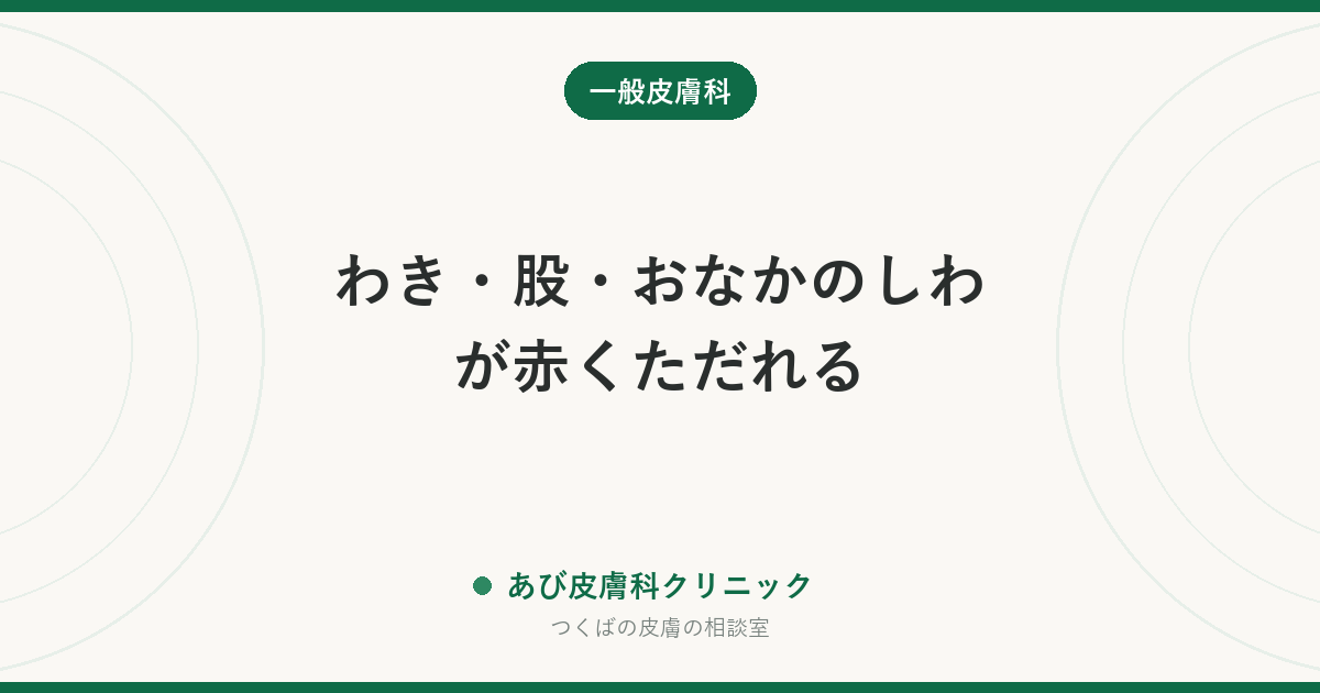 わき・股・おなかのしわが赤くただれる｜皮膚カンジダ症の特徴・あせもや水虫との見分け