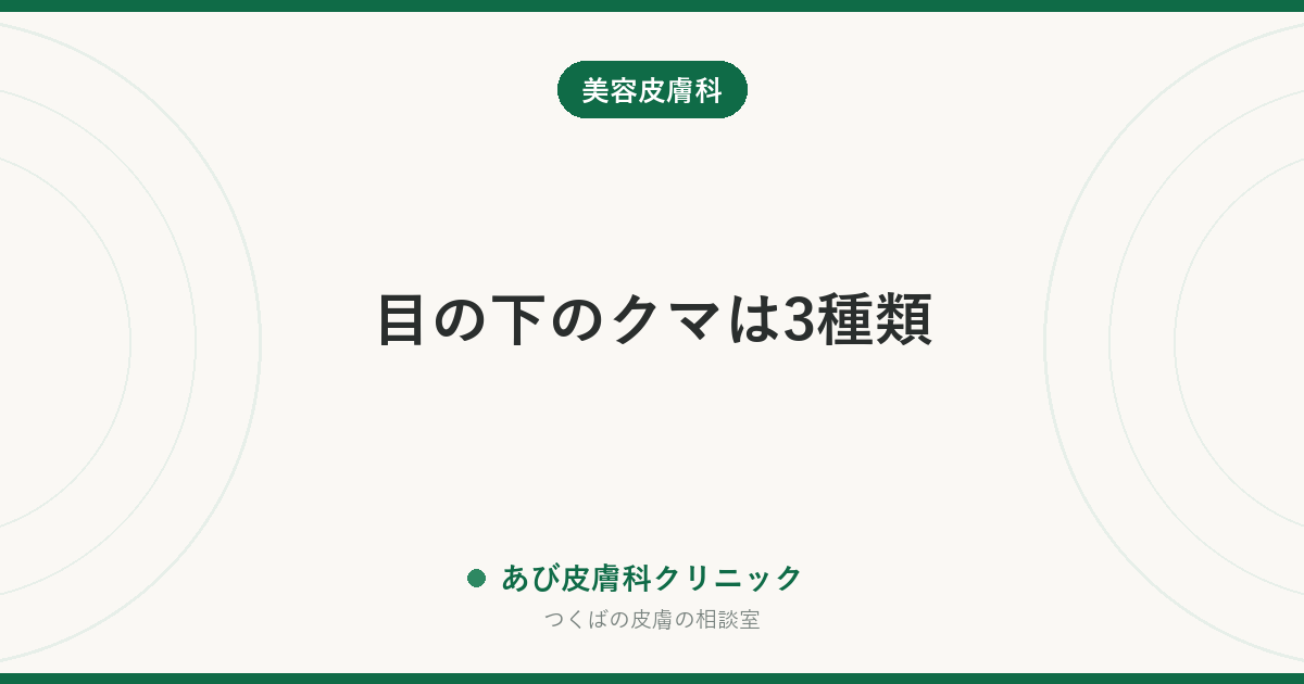 目の下のクマは3種類｜青・茶・黒の見分け方と、タイプ別にできる対策