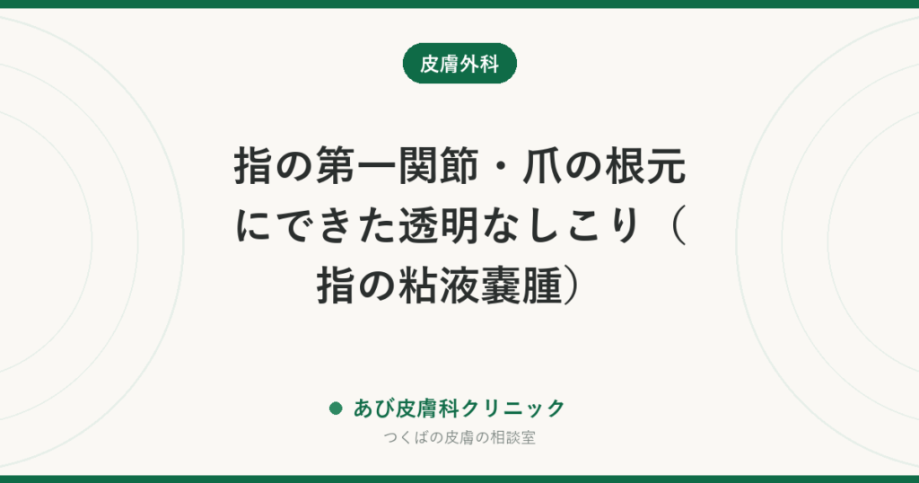 指の第一関節・爪の根元にできた透明なしこり（指の粘液嚢腫）｜へバーデン結節との関係、爪の縦溝、潰さずに治す方法