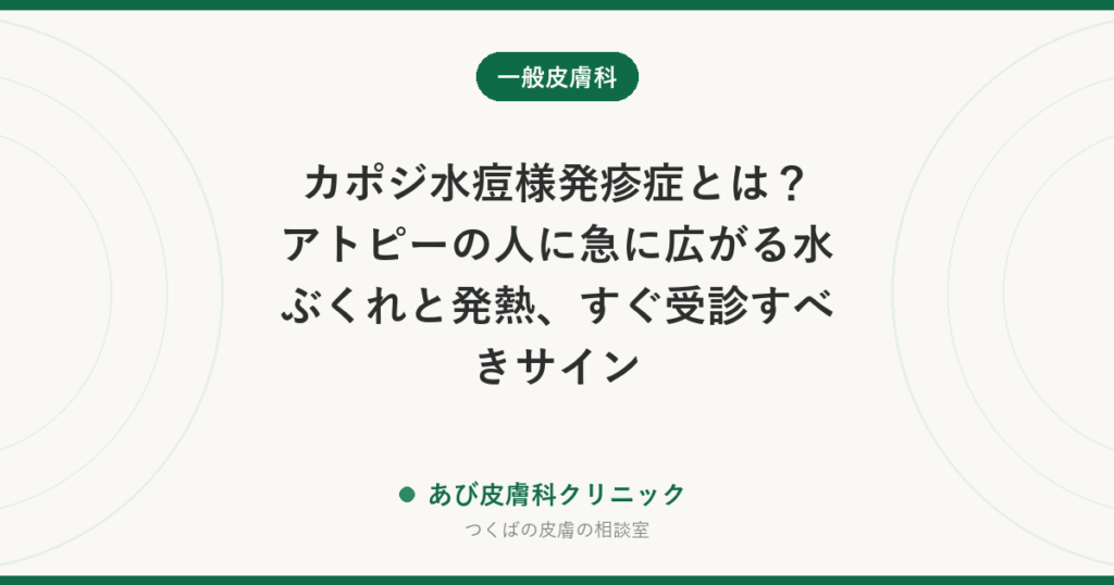 カポジ水痘様発疹症とは？アトピーの人に急に広がる水ぶくれと発熱、すぐ受診すべきサイン