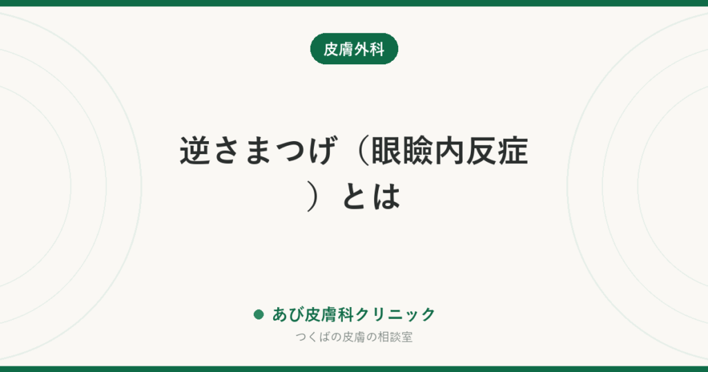 逆さまつげ（眼瞼内反症）とは｜子どもと大人で違う原因・目薬で治る？手術の目安