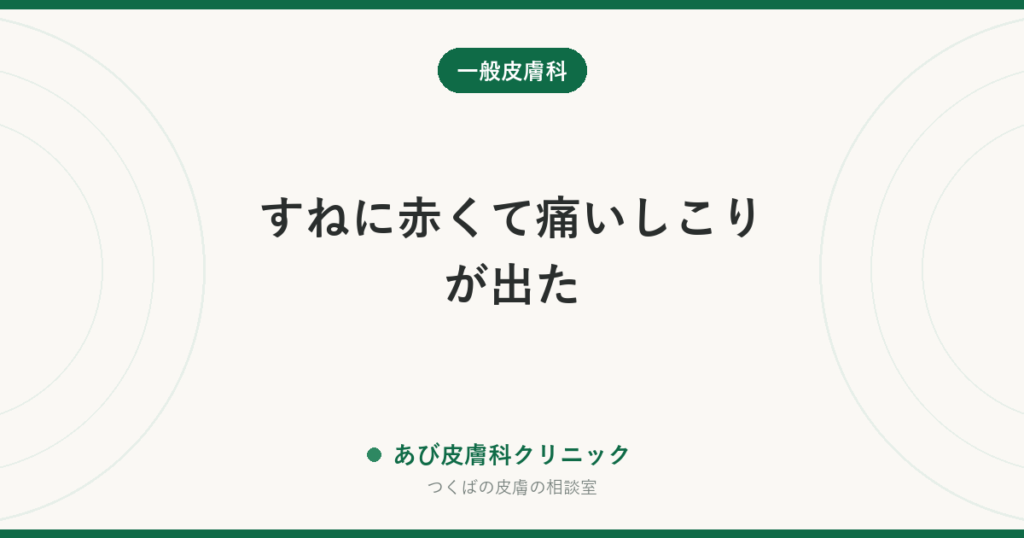 すねに赤くて痛いしこりが出た｜結節性紅斑の特徴と、放置してはいけない理由
