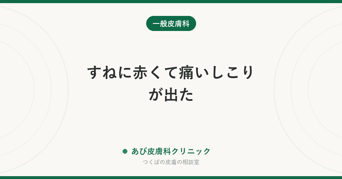 すねに赤くて痛いしこりが出た｜結節性紅斑の特徴と、放置してはいけない理由