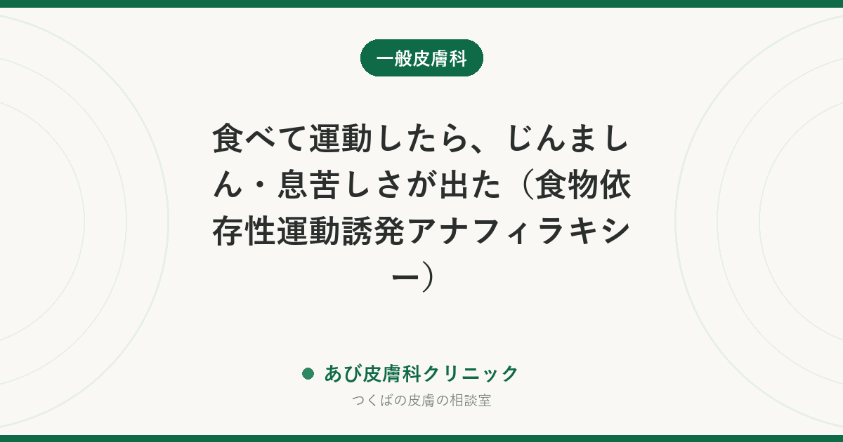 食べて運動したら、じんましん・息苦しさが出た（食物依存性運動誘発アナフィラキシー）｜原因の組み合わせと、すぐ119番を呼ぶべき症状