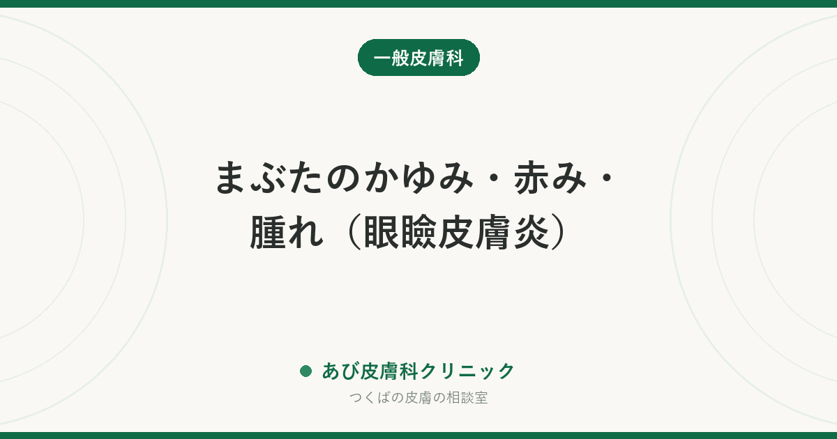 まぶたのかゆみ・赤み・腫れ（眼瞼皮膚炎）｜原因の見分け方と、目のまわりの薬の使い方