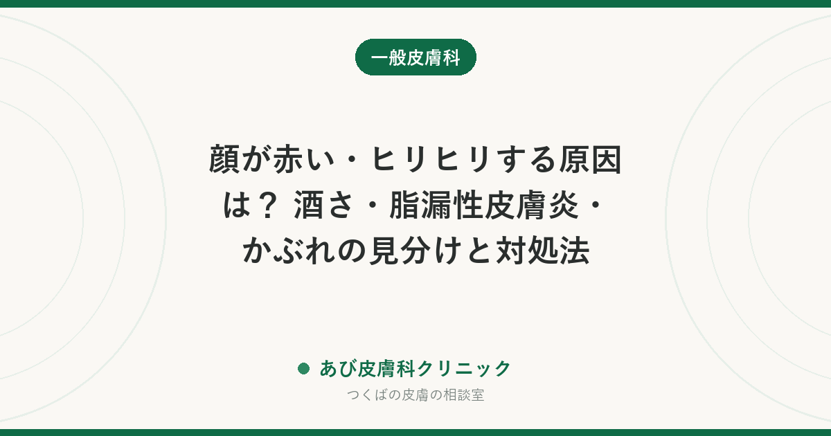 顔が赤い・ヒリヒリする原因は？ 酒さ・脂漏性皮膚炎・かぶれの見分けと対処法