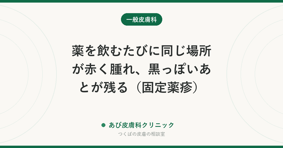 薬を飲むたびに同じ場所が赤く腫れ、黒っぽいあとが残る（固定薬疹）｜原因の薬の見つけ方と、すぐ受診すべきサイン