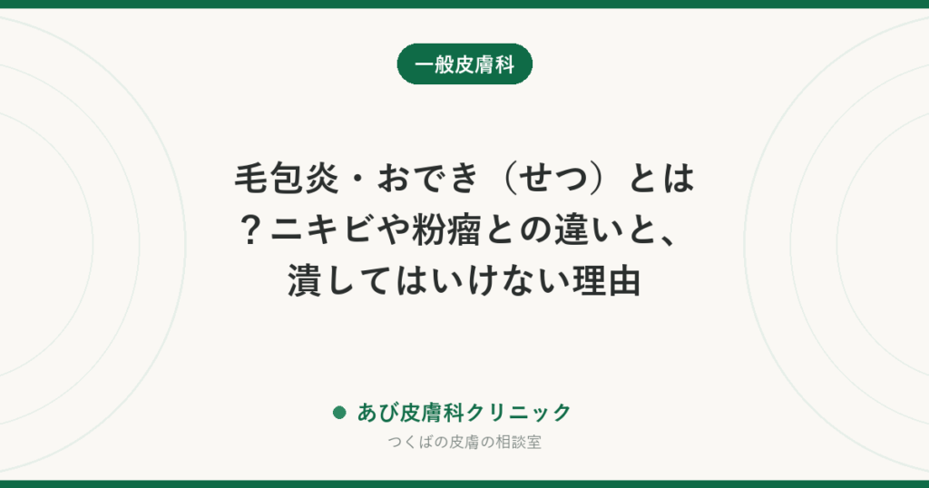 毛包炎・おでき（せつ）とは？ニキビや粉瘤との違いと、潰してはいけない理由