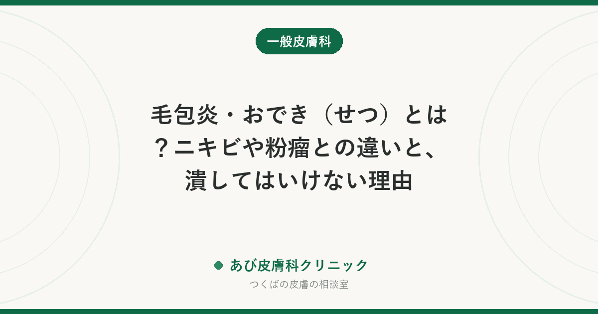 毛包炎・おでき（せつ）とは？ニキビや粉瘤との違いと、潰してはいけない理由