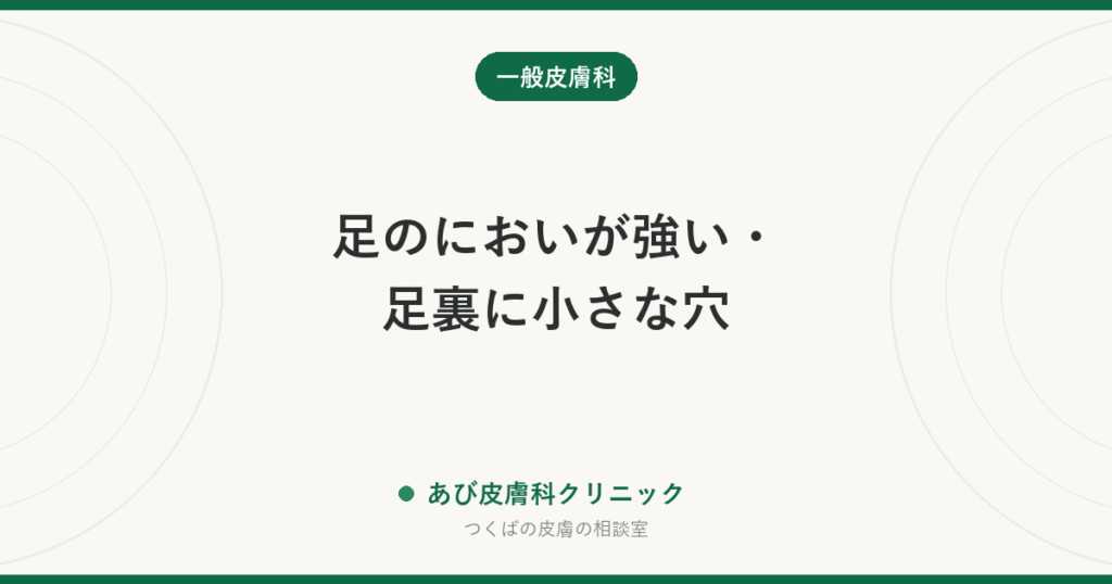 足のにおいが強い・足裏に小さな穴｜点状角質融解症という皮膚の病気と、水虫との違い
